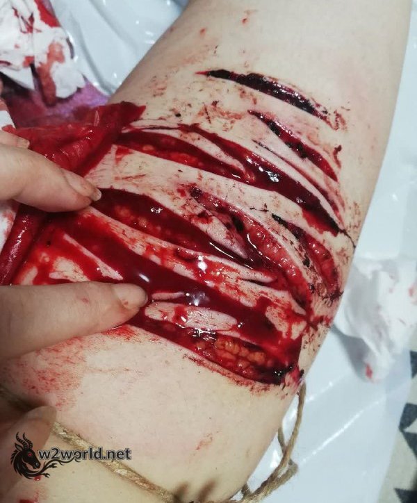 Perhaps she wanted to win the self-harm contest 01