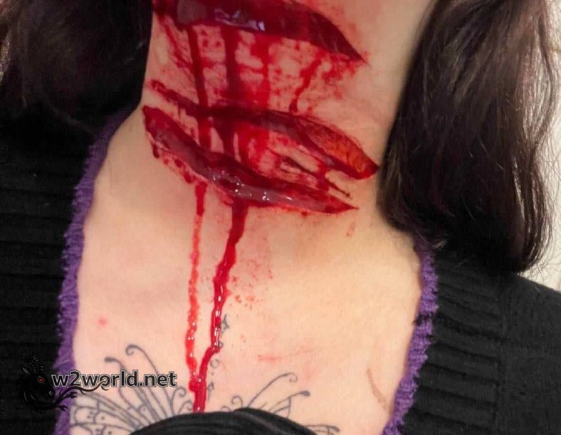 Perhaps she wanted to win the self-harm contest 03