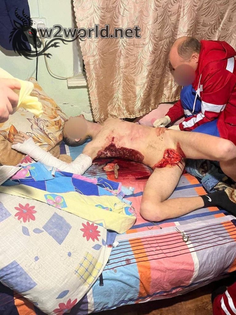 Woman Weighing 140kg Bites Off Man's Penis After Being Called Fat, Victim Dies Weeks Later