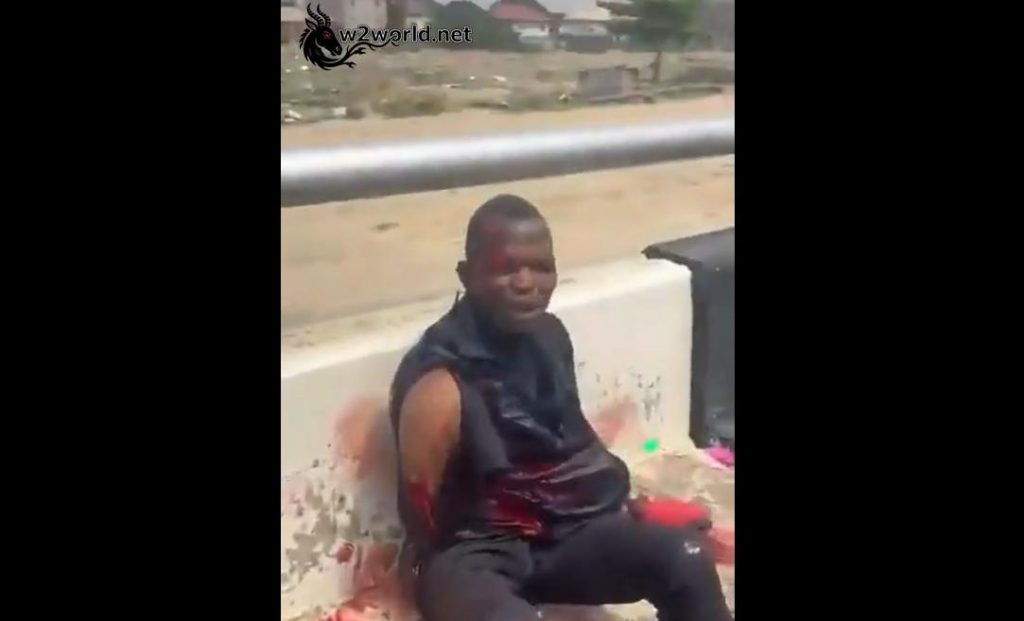 A delivery man lost an arm