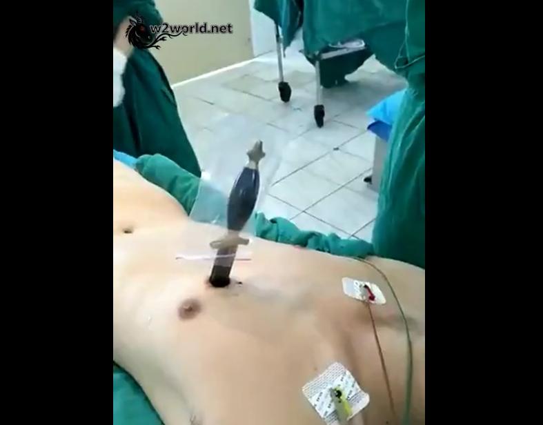 A healthcare worker was stabbed in the chest by a colleague