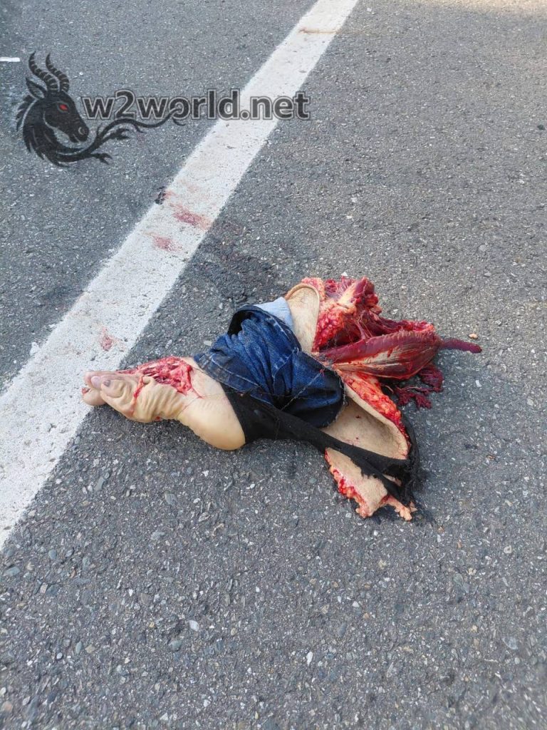 Two Killed in Brutal Attack on Zaragoza-Caucasia Highway, Feet Torn Apart