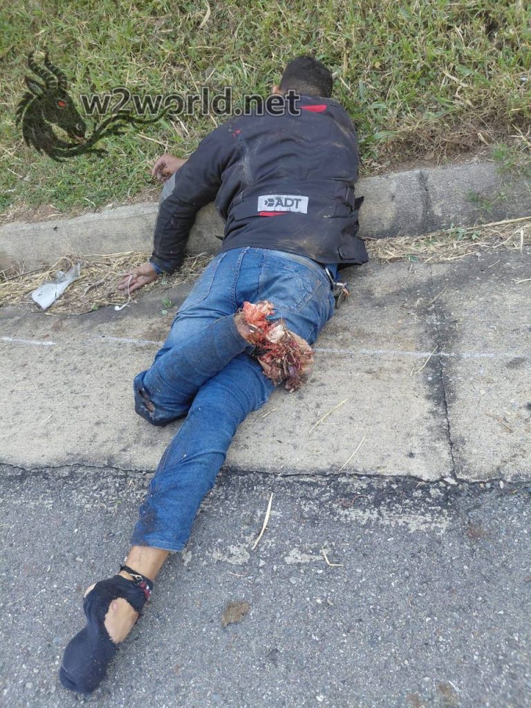 Two Killed in Brutal Attack on Zaragoza-Caucasia Highway, Feet Torn Apart 03