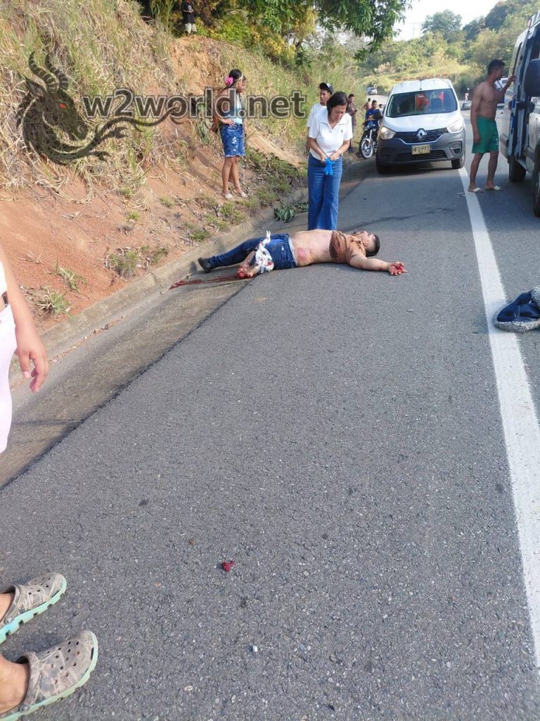 Two Killed in Brutal Attack on Zaragoza-Caucasia Highway, Feet Torn Apart 04