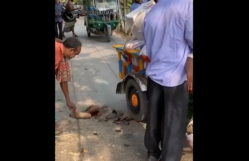 The elderly man lost his leg in a tricycle accident