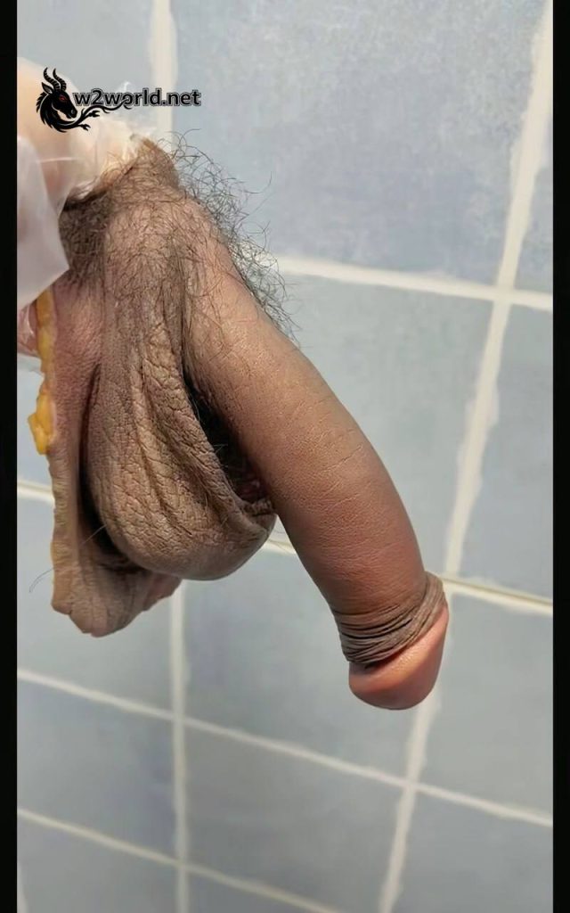 A bizarre collection by a man obsessed with severed penises in China 04