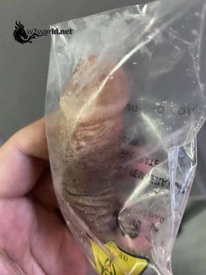 A bizarre collection by a man obsessed with severed penises in China 03