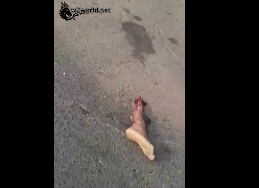  Man’s Foot Severed and Ejected, Couple Critically Injured
