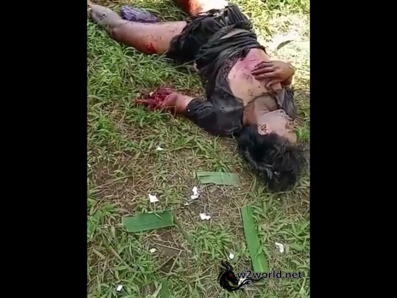 3 Young Men Suffer Severe Burns in Jumbo Firecracker Explosion, Pekalongan