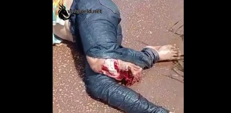 The woman's legs were almost completely severed in the motorcycle accident