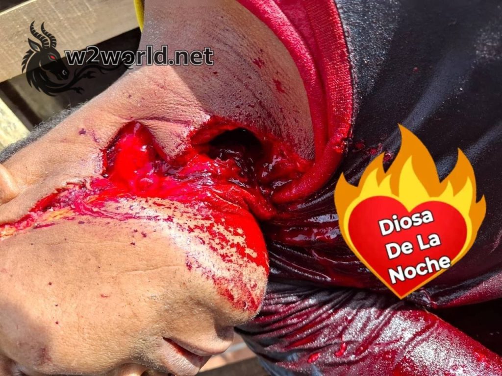 Workplace accident - man's throat slashed to death. 01