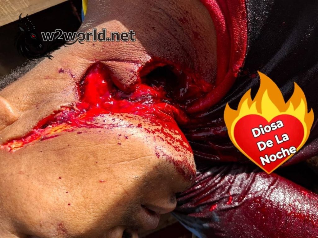 Workplace accident - man's throat slashed to death. 03