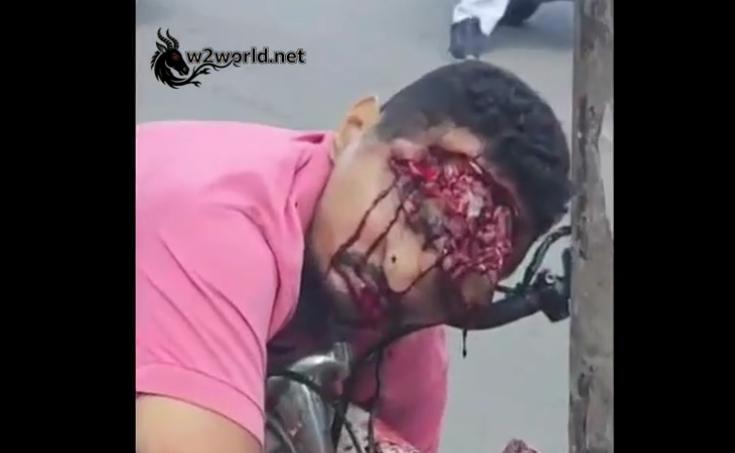 Mechanic Dies After Crashing ATV Into Pole on Avenida Leste-Oeste in Pirambu, Fortaleza