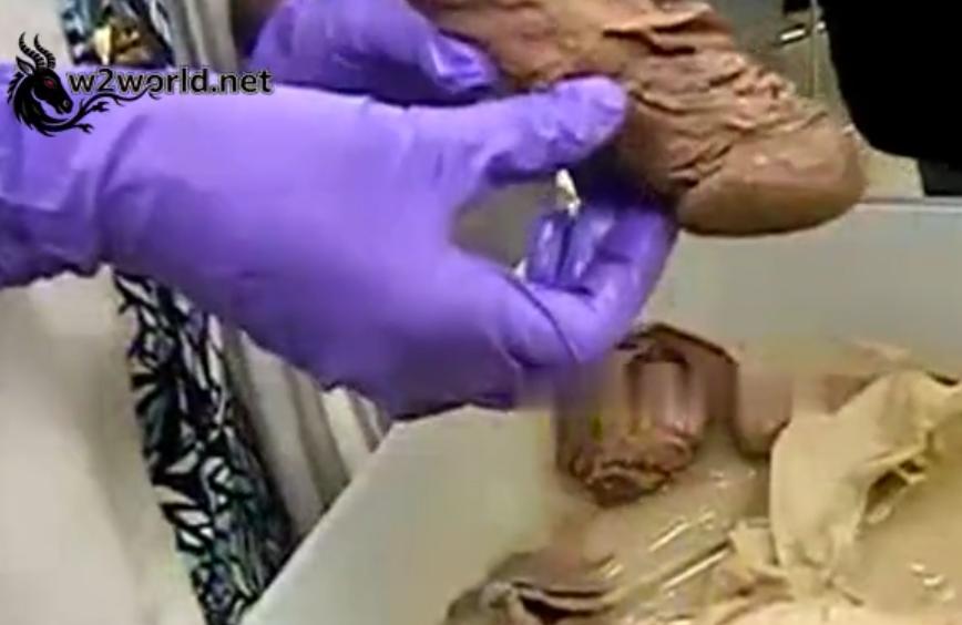 Video of severed penises preserved for medical research