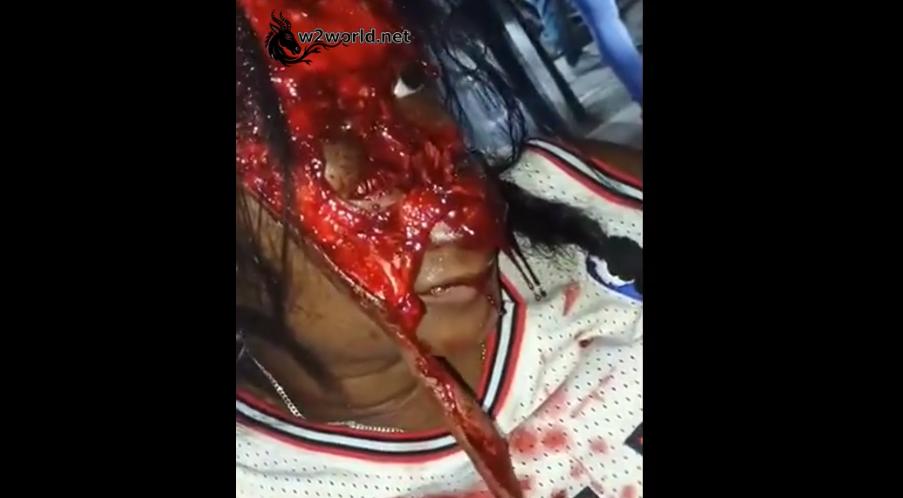 Two Women Seriously Injured in Traffic Accident in Dominican Republic