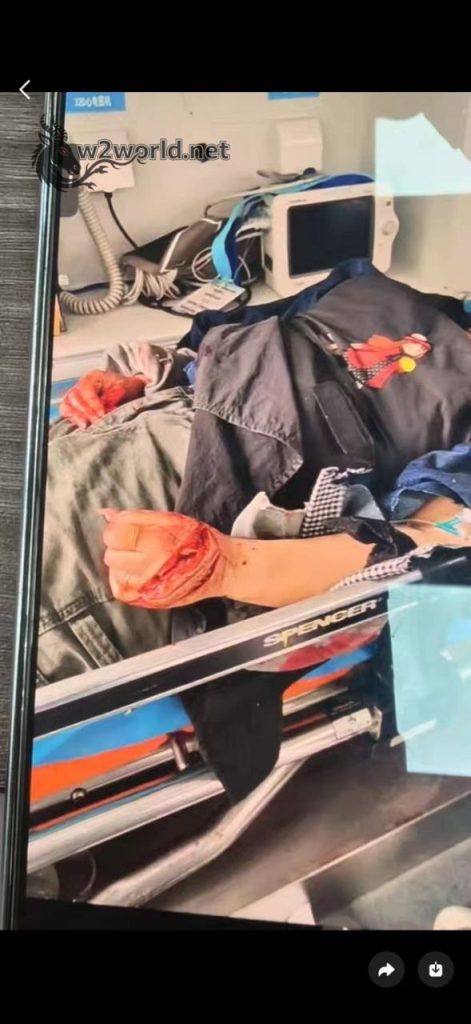 A woman was slashed and seriously injured in a dispute between street vendors