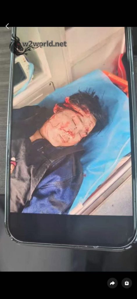 A woman was slashed and seriously injured in a dispute between street vendors 01