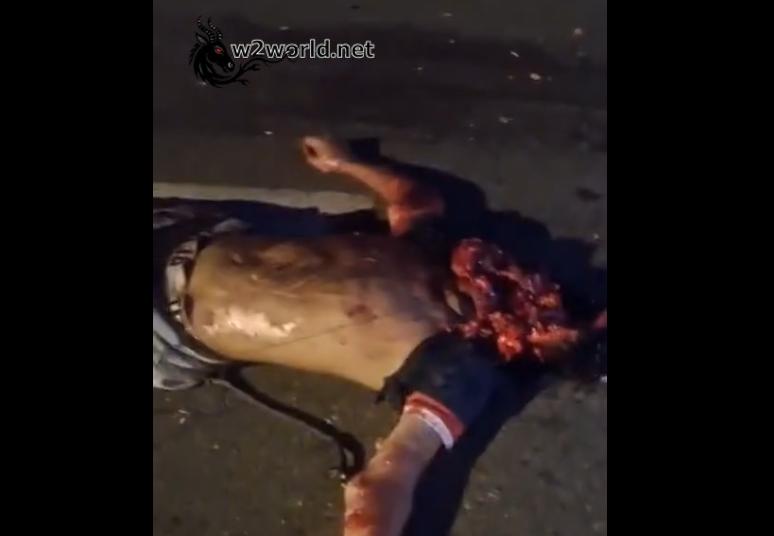 The horrific accident resulted in the victim's body being torn apart and crushed