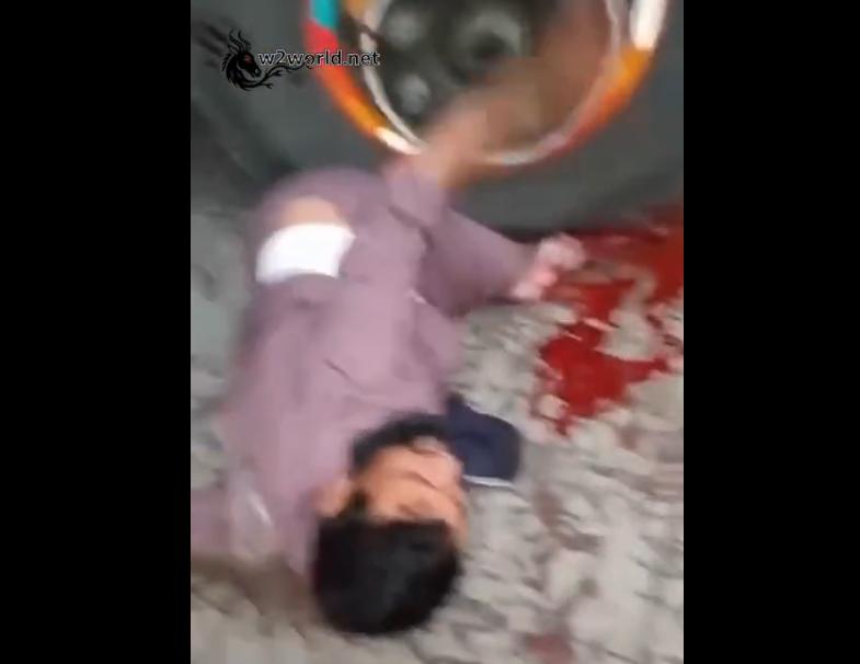 The man's leg was trapped under the truck's wheel