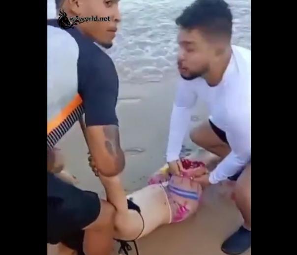 19-Year-Old Woman Loses Leg in Shark Attack at Boa Viagem Beach, Recife