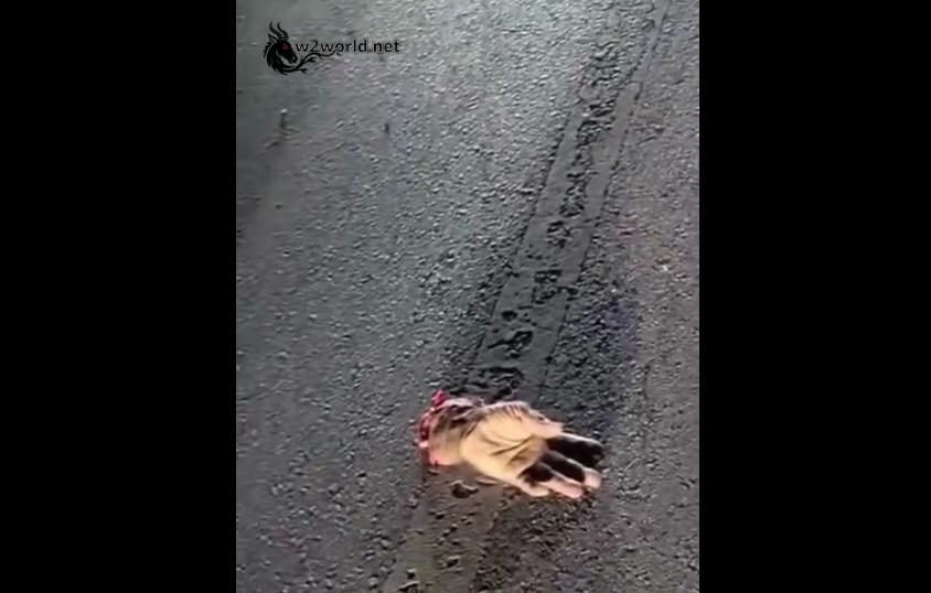 Man's Hand Completely Severed and Thrown Nearby in Esperanza Incident, Dominican Republic