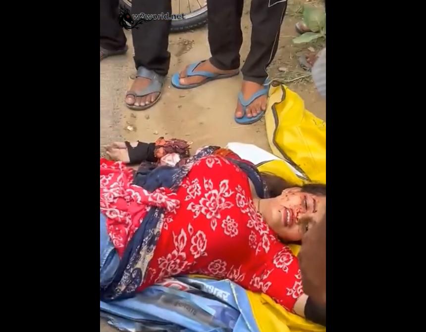 Traffic accident: A woman had one arm severed