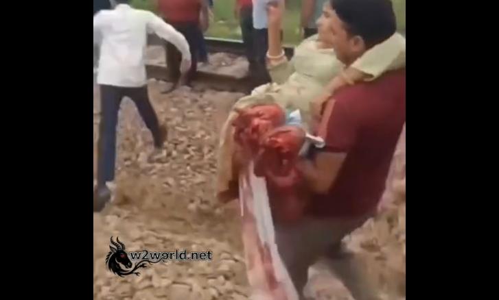 The woman had both her legs severed by a train