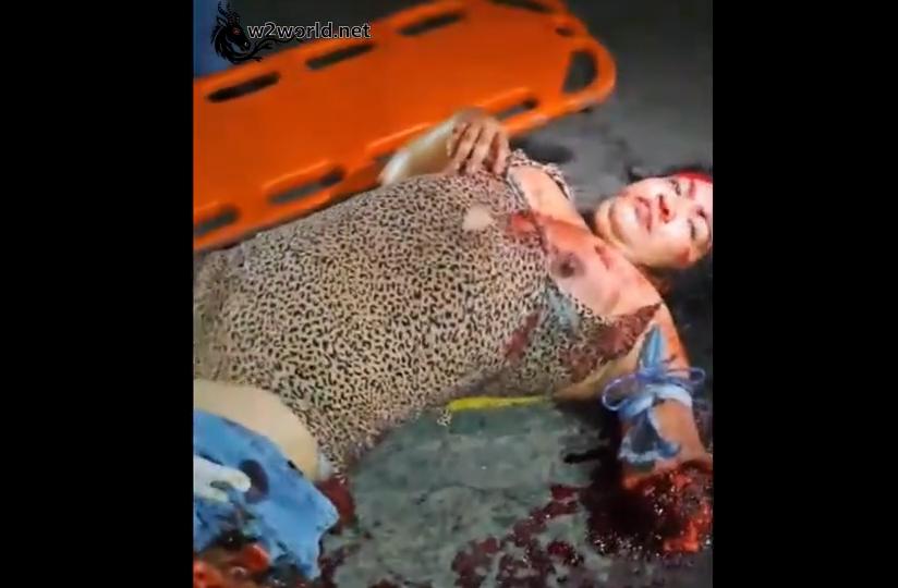 Gruesome Motorcycle Accident Leaves Woman with Amputated Arm and Mangled Leg